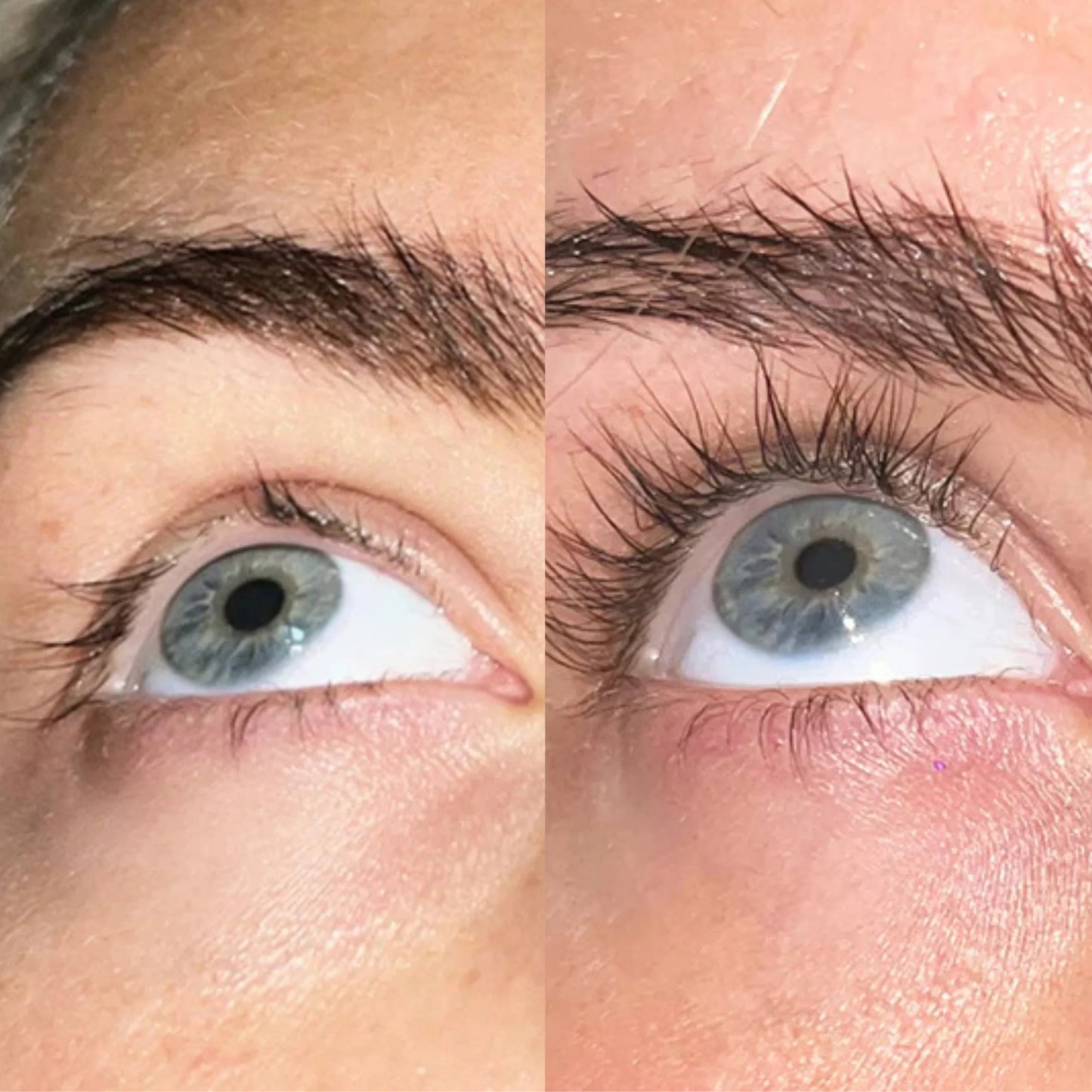 Nutrituals Eyelash Growth Serum – Length & Density